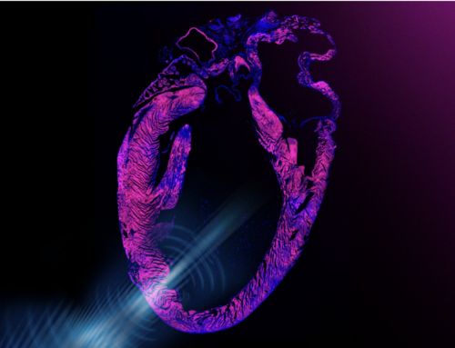 Ultrasound-Based Pacemaker Noninvasively Steadies The Heart